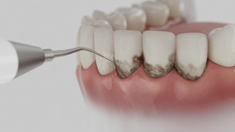 Reliable Dental Implants contractor in Riverview, MI by Smile Center Dentistry